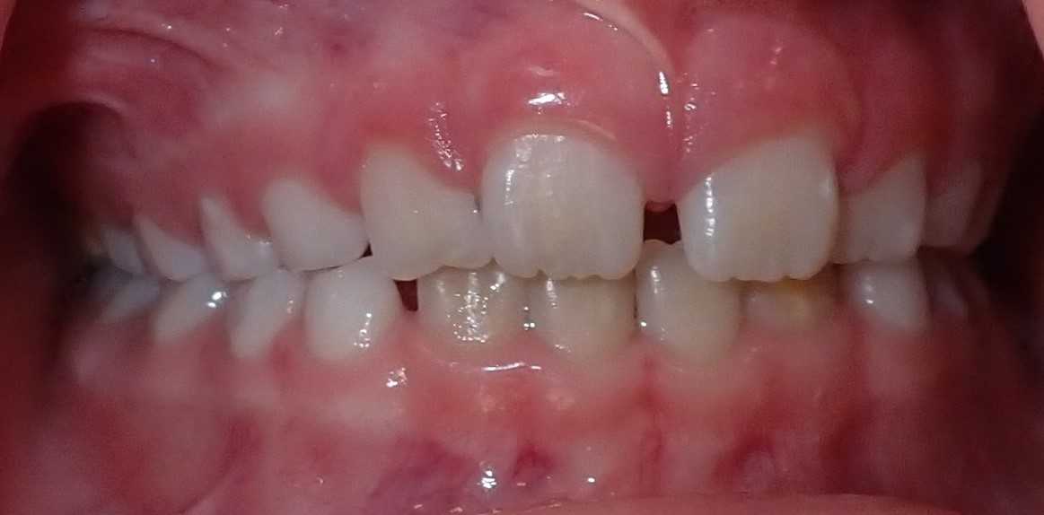 teeth