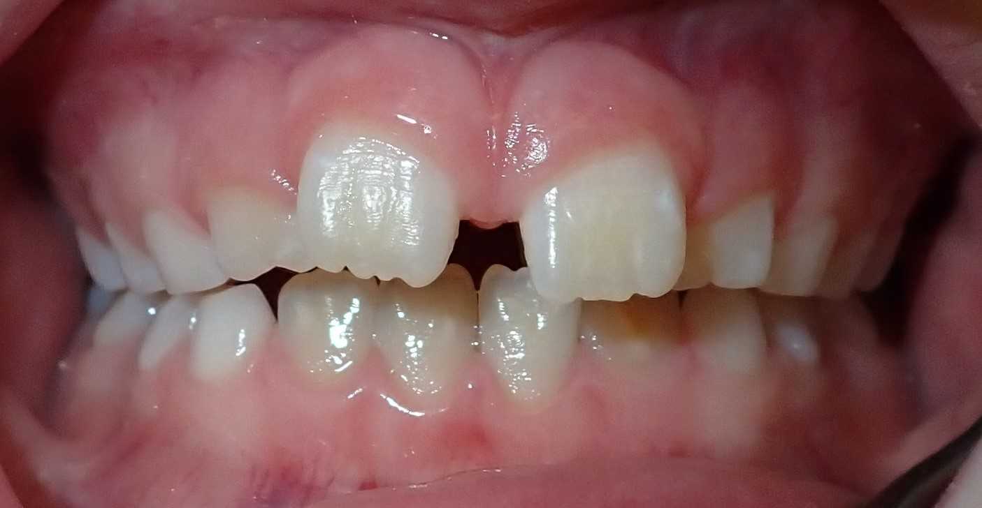 teeth