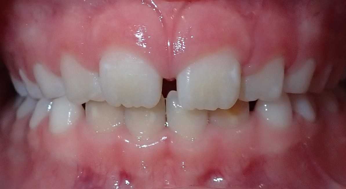 teeth