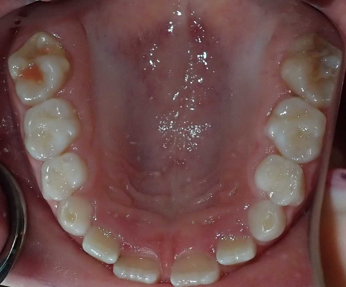 teeth