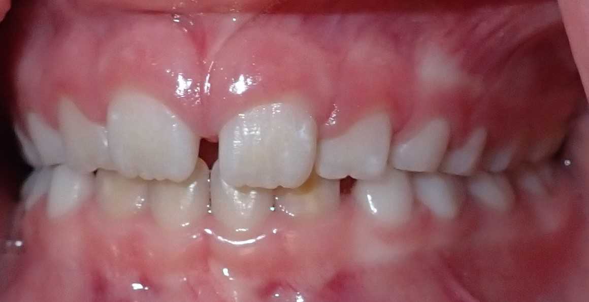teeth