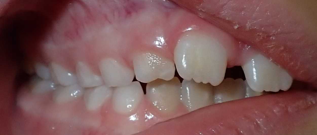 teeth